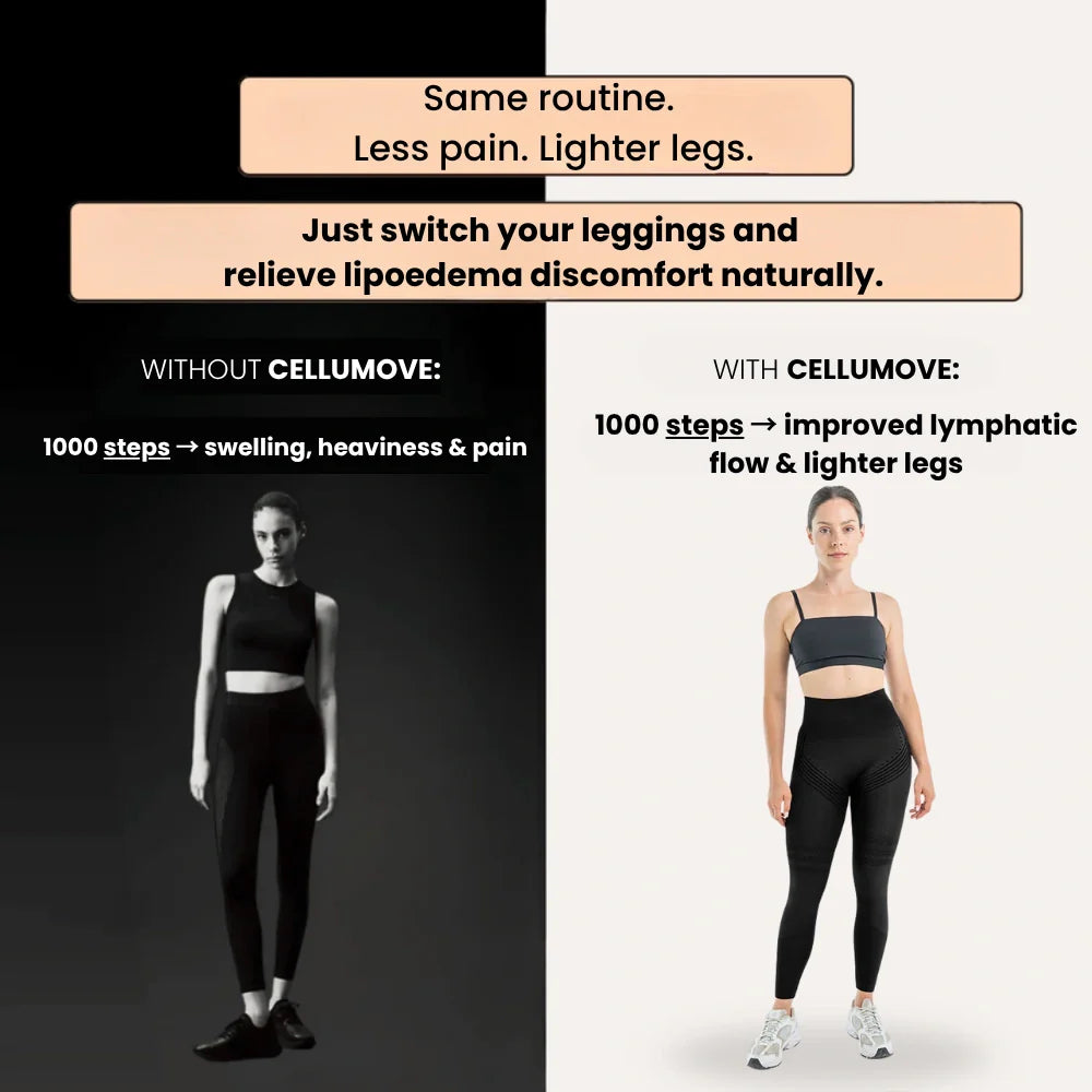Cellumove 3D Legging – Say goodbye to lipoedema pain and swelling naturally
