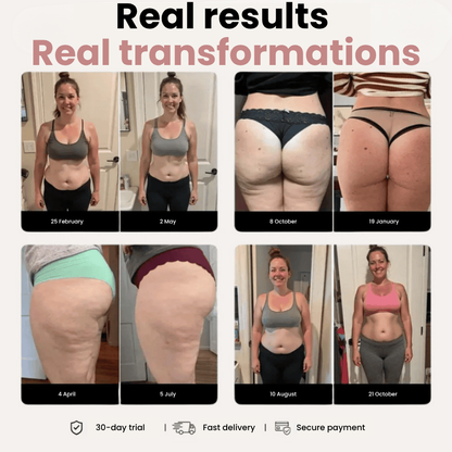 Cellumove 3D Legging – Say goodbye to lipoedema pain and swelling naturally